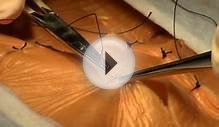 Surgical Technologist Program - Virtual Tour - Great Lakes